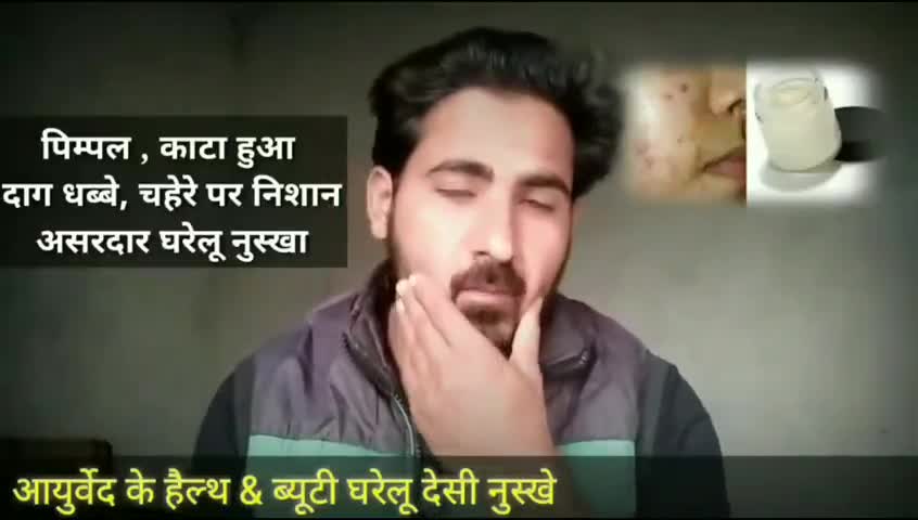 Modinagar Ghaziabad मोदीनगर Gharelu Pimples Ka Elaj Kare Pimples