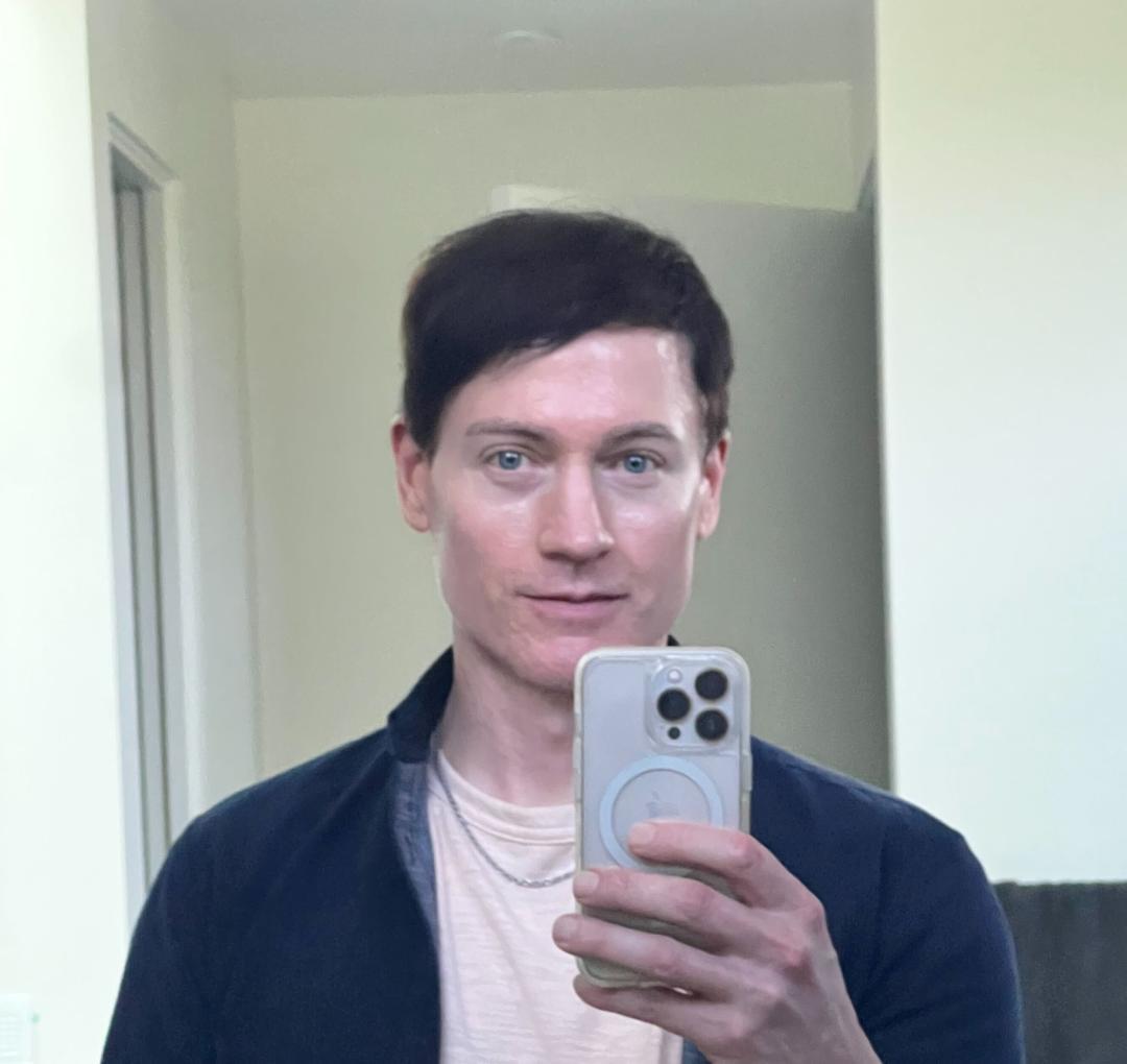 Millionaire who spends ₹16 crore a year on his body shares pic of his 'baby face'