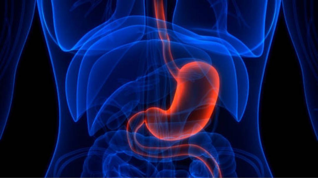 Early warning signs of stomach cancer that are hard to recognise