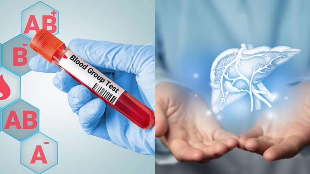 Blood type may raise life-threatening liver disease risk 