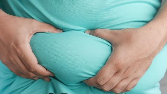 How is childhood obesity and baby fat different?