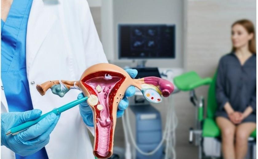 Are gynaecological cancers rising among young women?