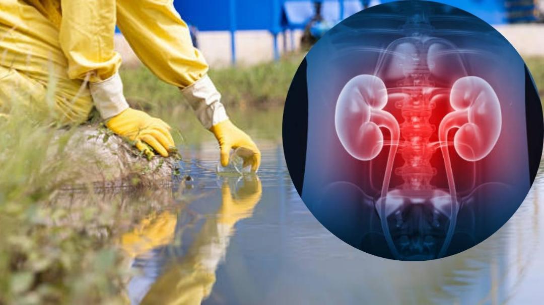 How does uranium affect your kidneys?