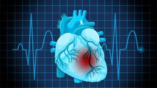 Doctor shares 5 habits to prevent heart attack