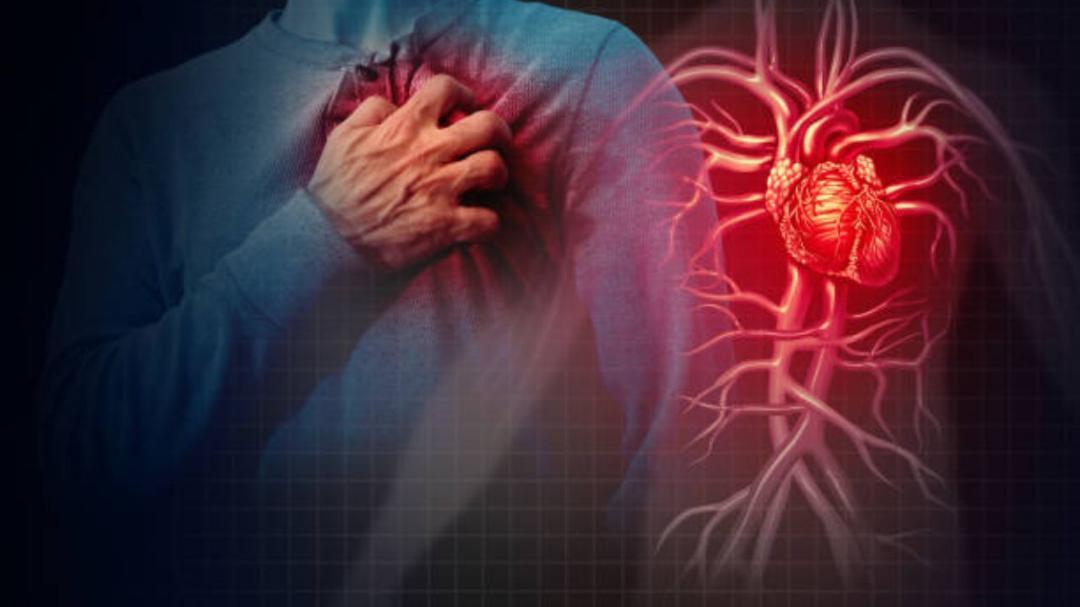 What is the difference between a stroke and a heart attack?