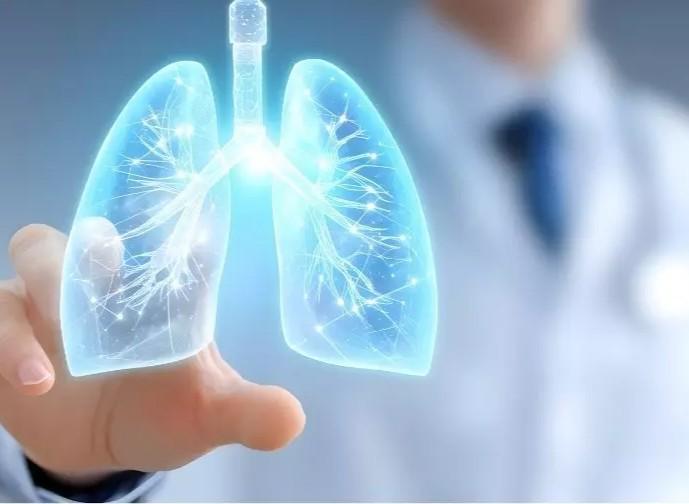 Lung cancer rising rapidly among non-smokers in cities