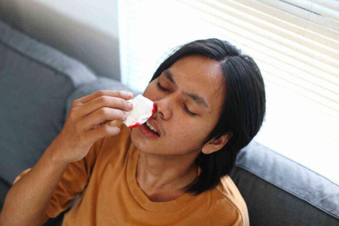 Expert reveals common causes of nosebleeds