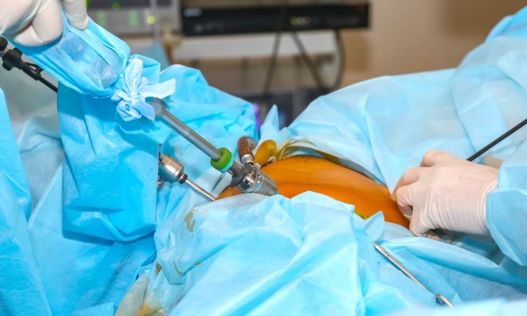 Minimally invasive aortic repair saves 78-year-old