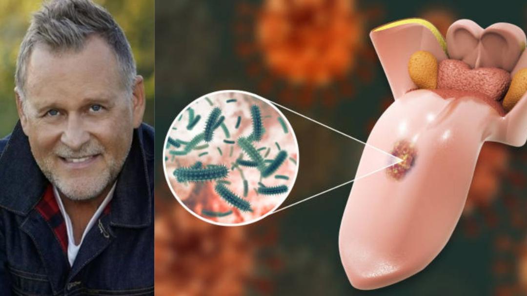 Dave Coulier reveals new cancer diagnosis after lymphoma victory