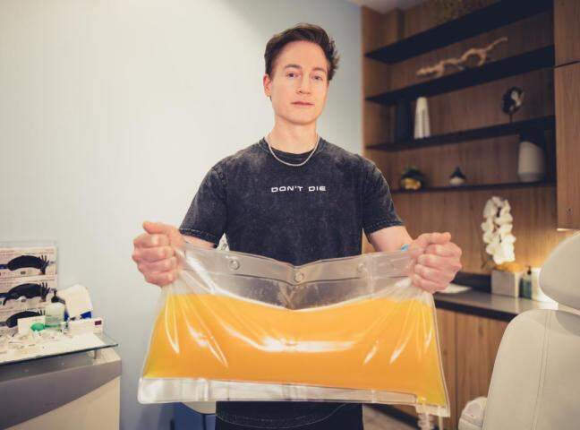 'Age reversing' millionaire Bryan replaces all his body's plasma, shows it filled in bag