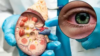 What eye symptoms could be warning of early kidney disease?