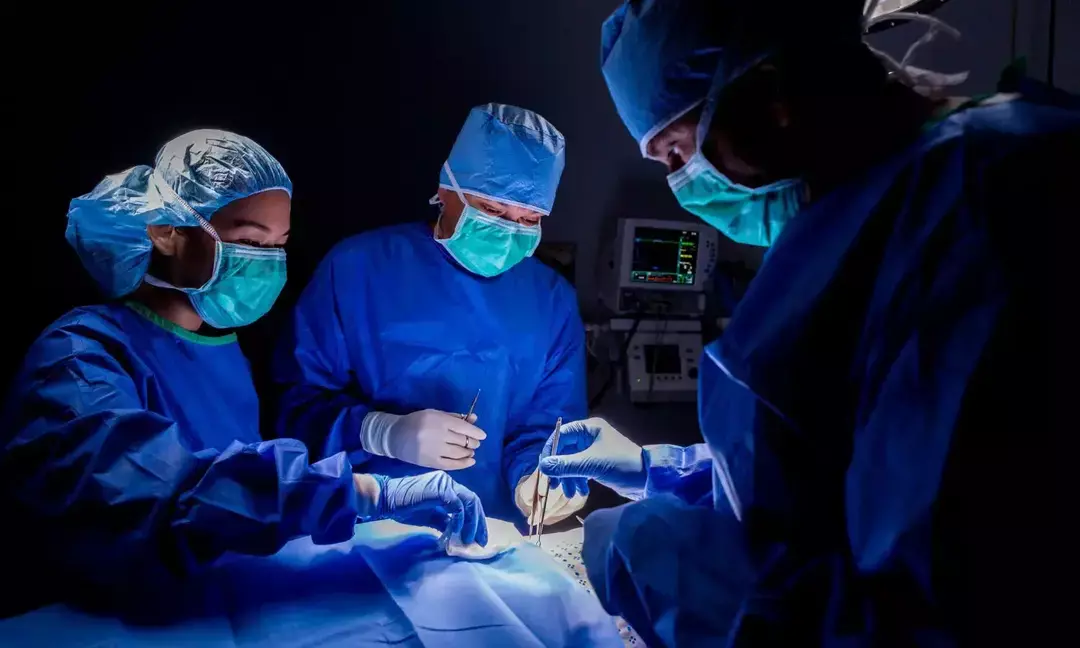 Massive 180 g clot removed in rare DVT-PE rescue