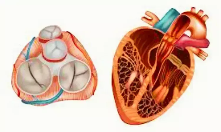 Diabetes greatly raises risk of calcific valve disease: Study