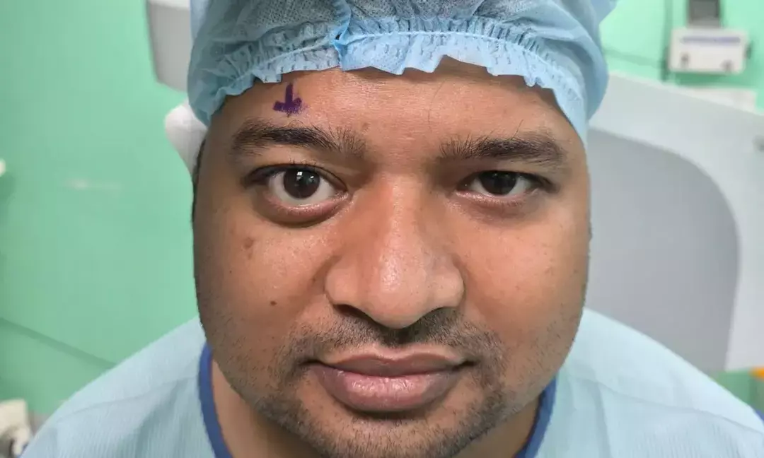 Hidden orbital tumour behind eye successfully removed by doctors