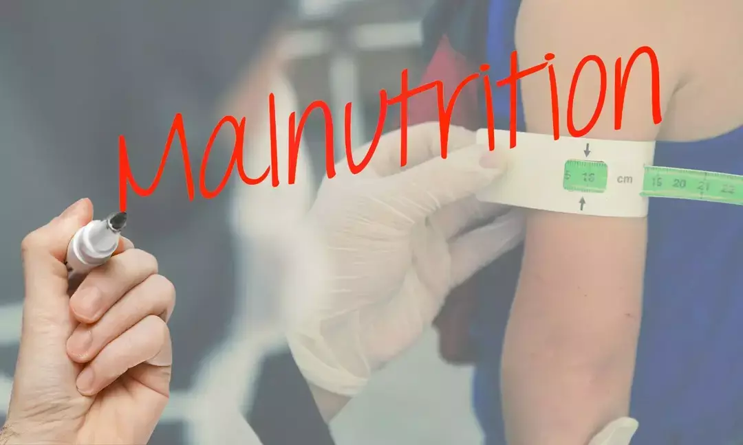 Climate-vulnerable districts face higher child malnutrition: Study