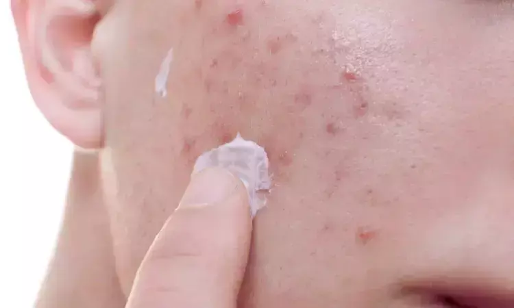 Broccoli extract cream shows promise for acne scars