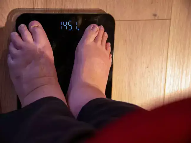 China’s Sciwind eyes 10% share in obesity drug market